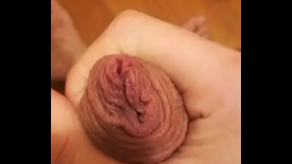 Hairy boy